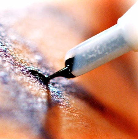 Tattoo Removal Creams and NonLaser Tattoo Removal