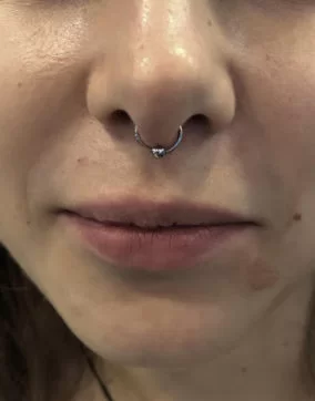 chăm sóc lỗ xỏ